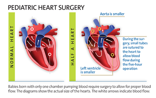 Diagram of a pediatric heart